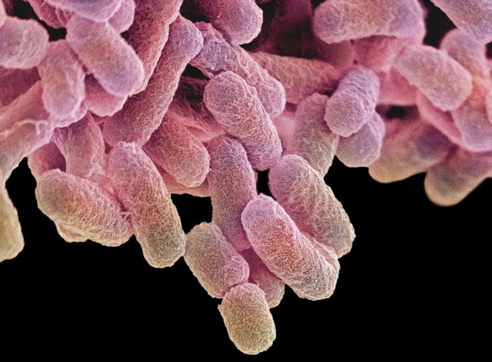 PHOTO: Bacteria is seen under a scanning electron micrograph.