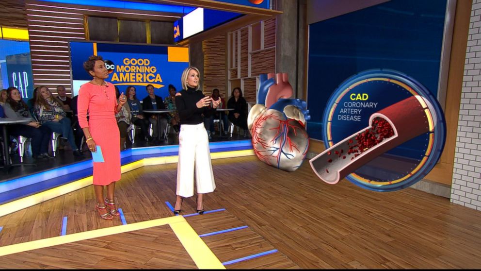 PHOTO: ABC News' chief medical correspondent Dr. Jennifer Ashton uses a 3-D augmented reality human model to demonstrate what a traditional heart attack caused by coronary artery disease looks like. 