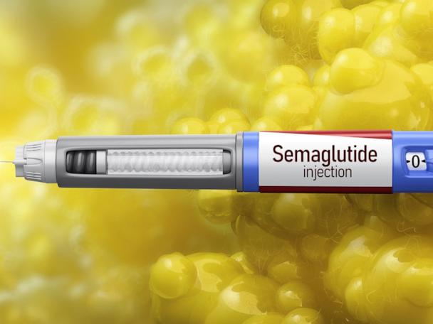 semaglutide alcohol reddit Demand for weight loss drugs prompts online alternatives, compound  pharmacies