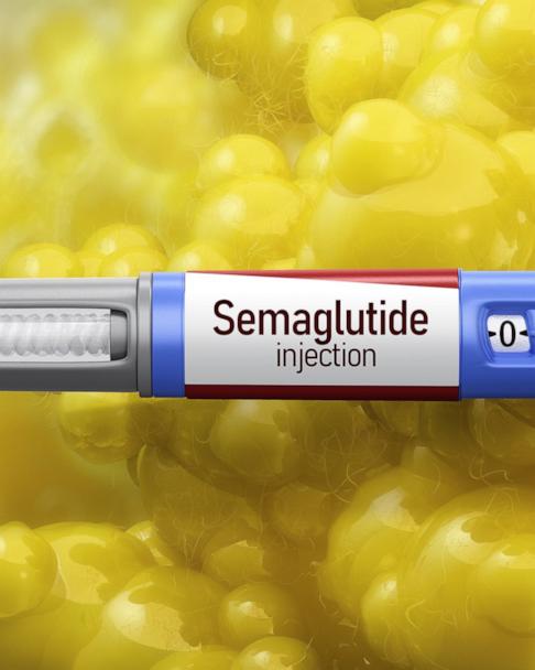 retatrutide a glp 1 Retatrutide Promises Big Weight Loss, but Safety Remains a Question