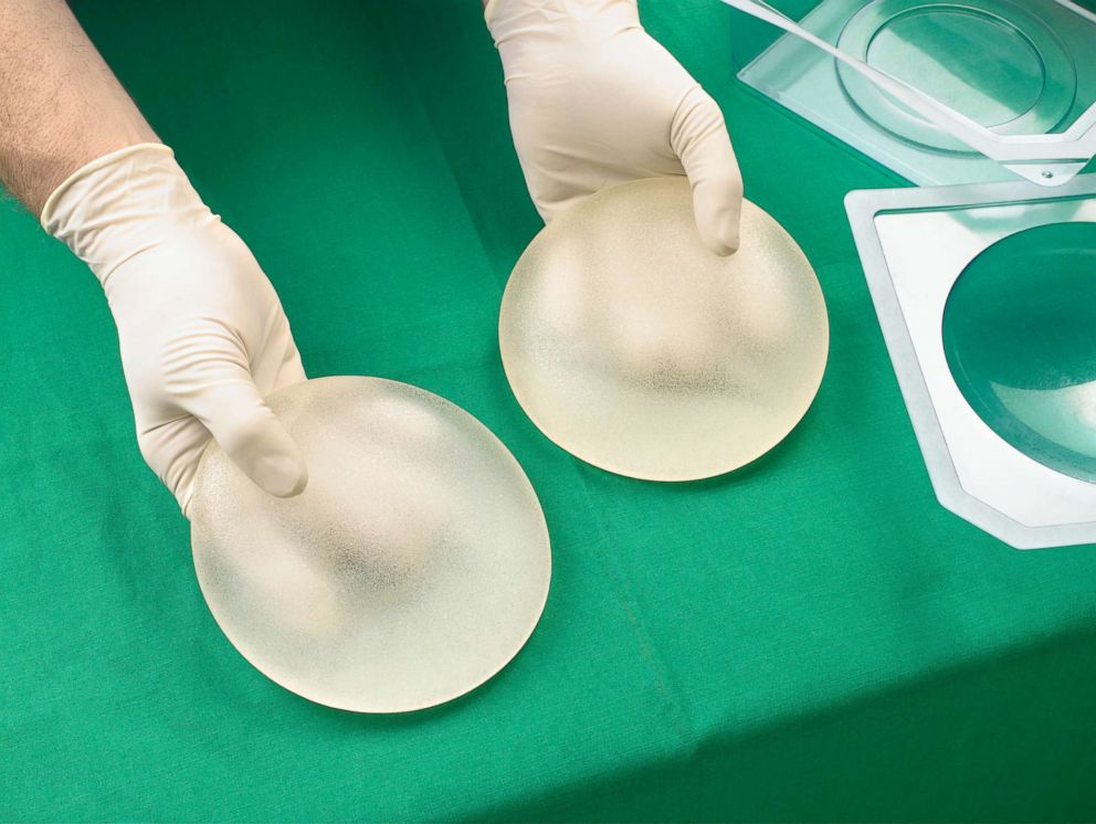 PHOTO: A surgeon holds silicone breast implants in this undated stock photo.