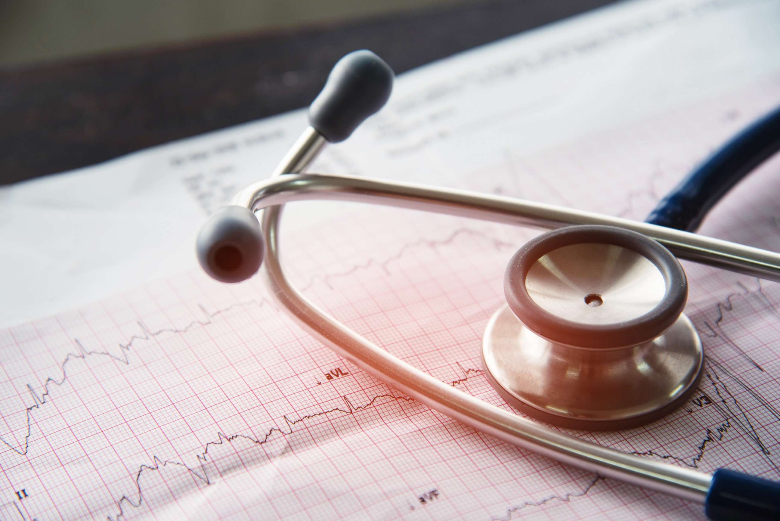 PHOTO: A stethoscope sits on a print out of an EKG test result.