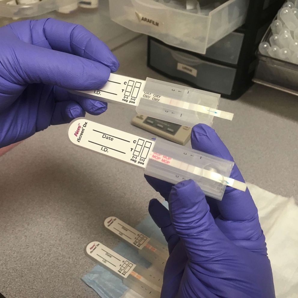 PHOTO: A staff member at CleanSlate, an addiction treatment center in Anderson, Ind., tests patients' urine to make sure they adhere to their buprenorphine regimen.