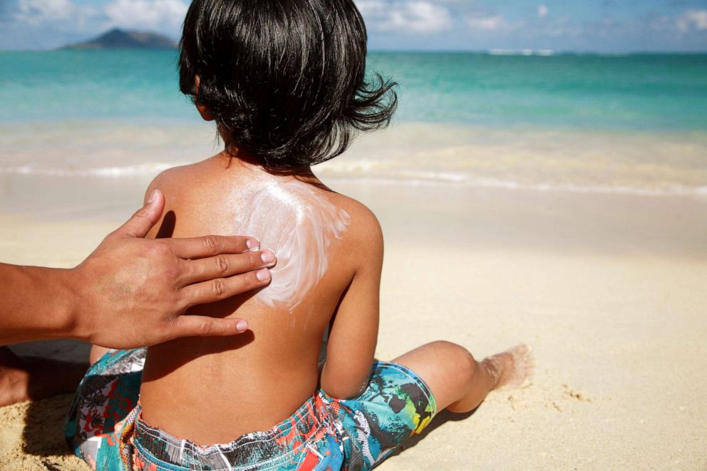 PHOTO: A person applies sunscreen to a child in this stock photo.