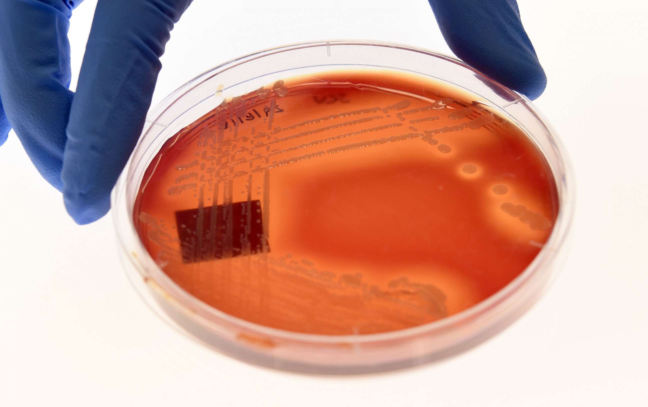 PHOTO: Jean Lee, a PhD student at Melbourne's Doherty Institute, displays the superbug Staphylcocus epidermidis on an agar plate in Melbourne, Sept. 4, 2018.