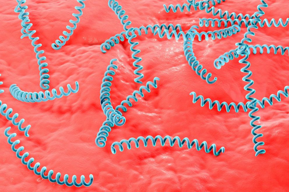 PHOTO: Computer illustration of Treponema pallidum, the bacterium which causes syphilis.