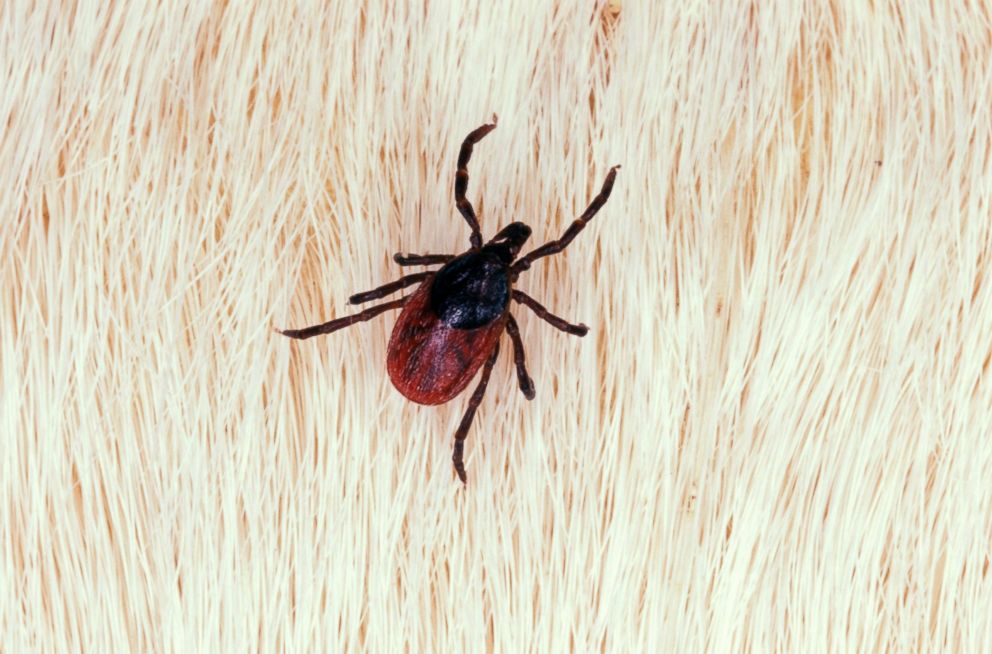 PHOTO: An adult female western blacklegged tick is pictured in this undated stock photo.