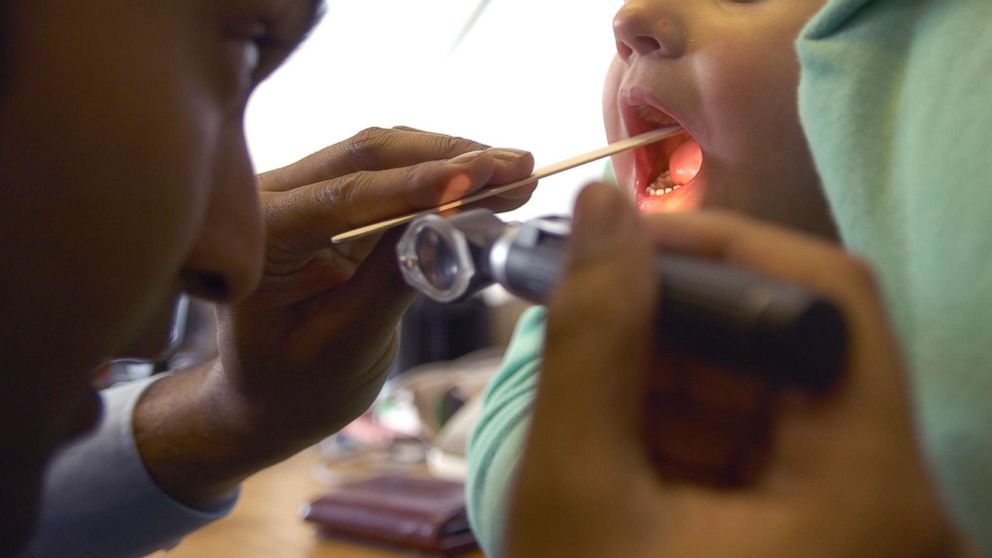 For kids who get their tonsils removed, age might matter ...