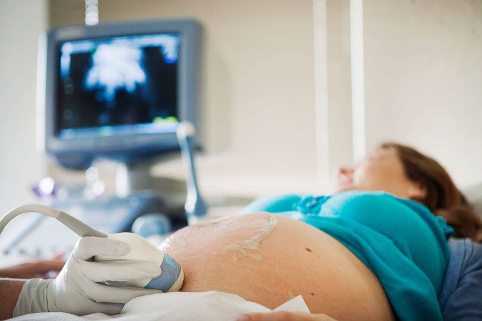 PHOTO: Pregnant Woman receives an ultra-Sound in this undated stock photo.