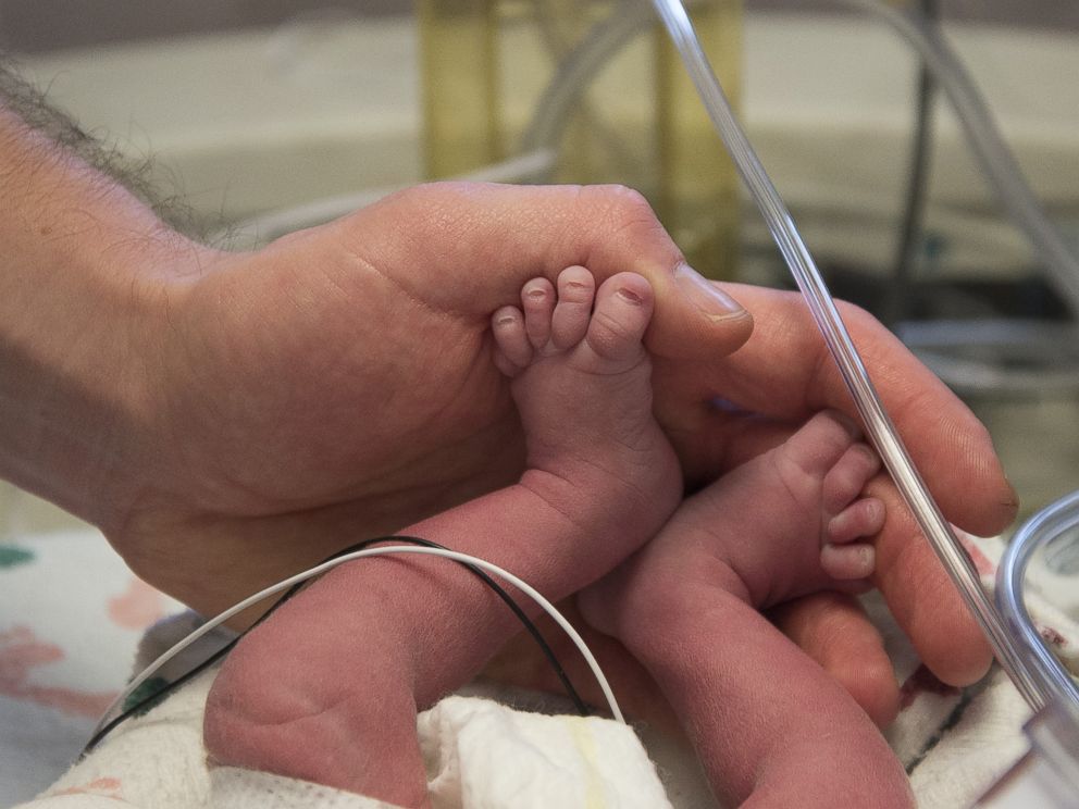 PHOTO: The first American baby born from a transplanted uterus is photographed here after being born at the Baylor University Medical Center in Dallas, Texas.