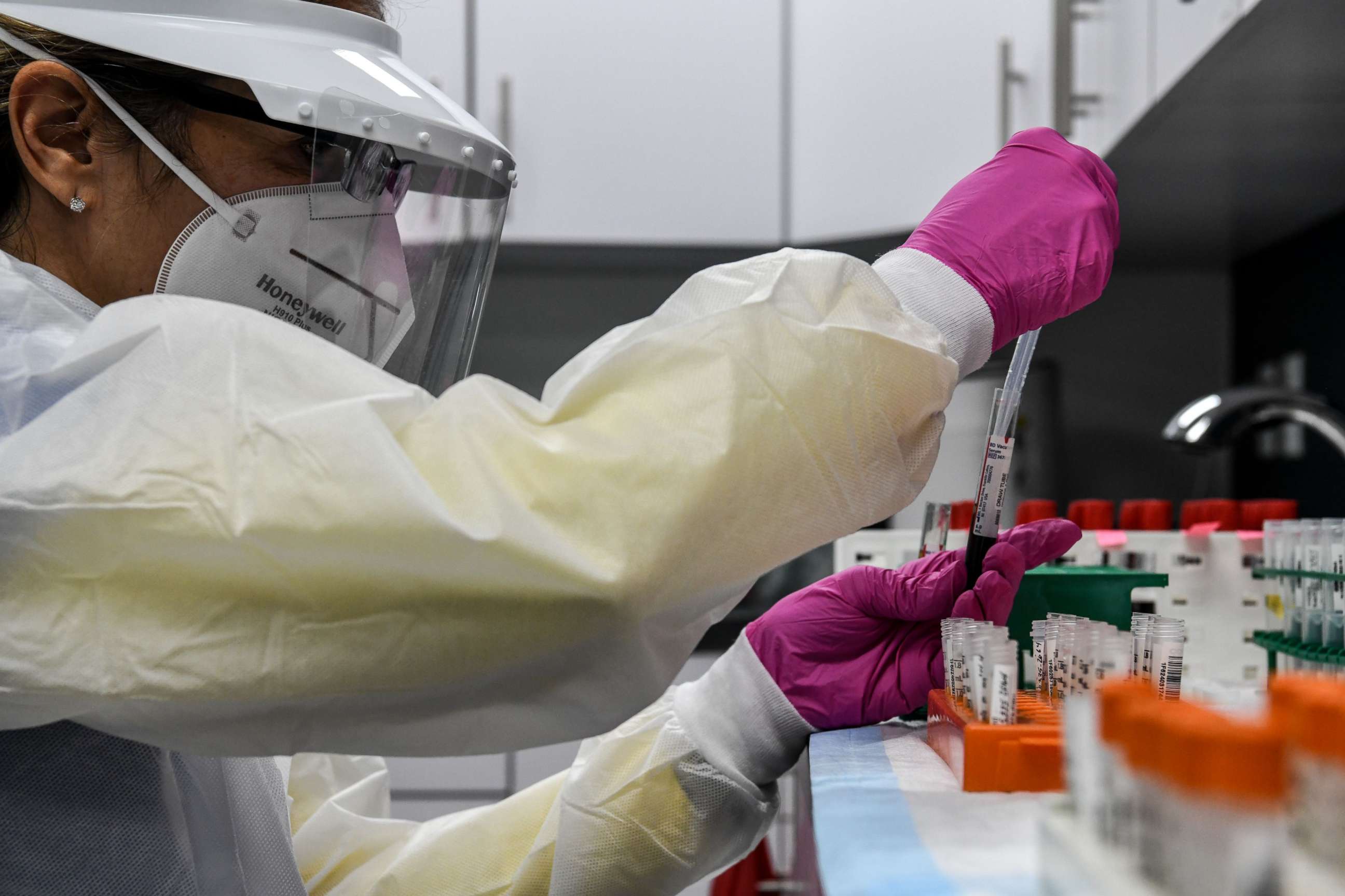 PHOTO: In this file photo a lab technician sorts blood samples for COVID-19 vaccination study at the Research Centers of America in Hollywood, Fla., on Aug. 13, 2020.