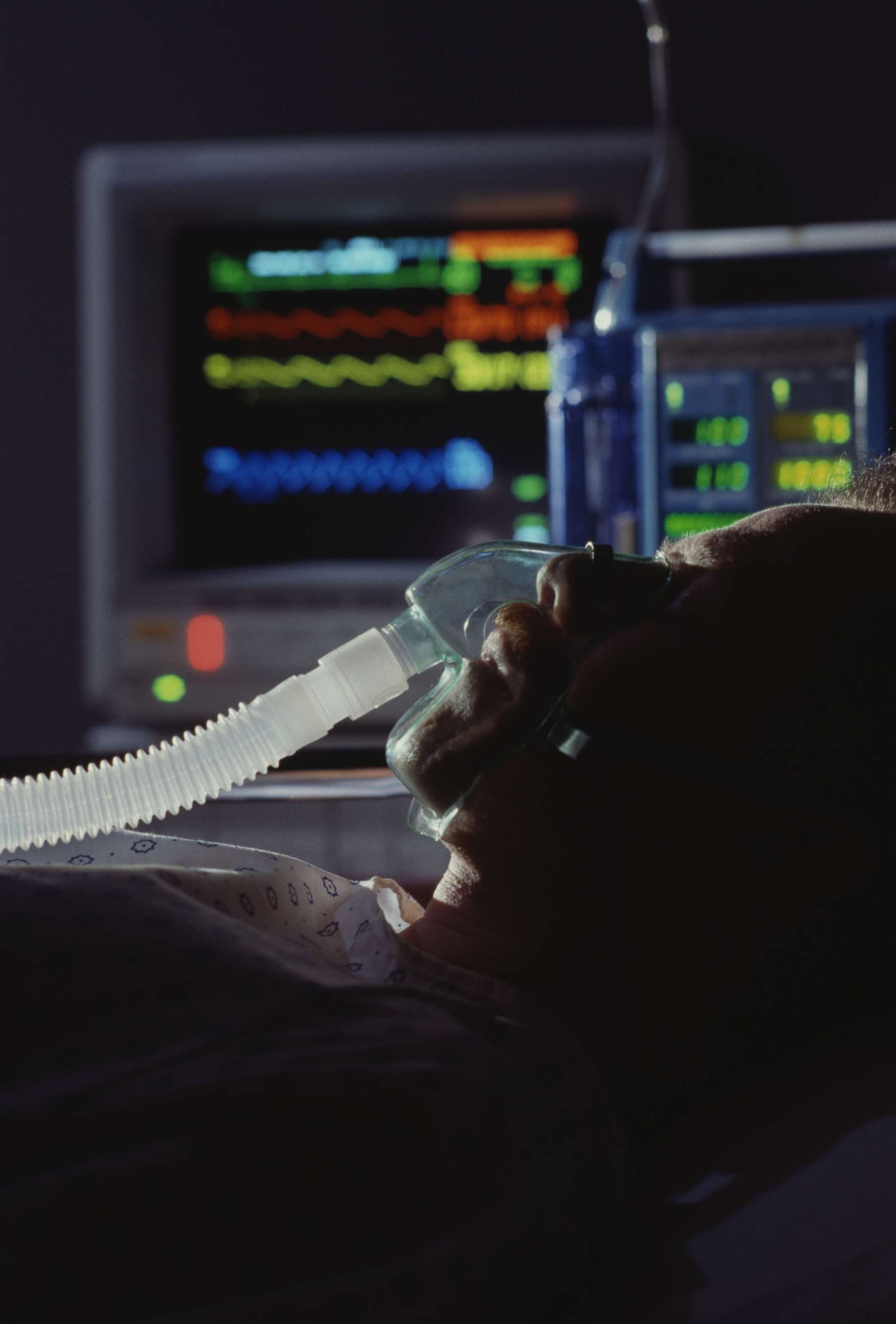 PHOTO: An undated stock photo show a person on a ventilator.