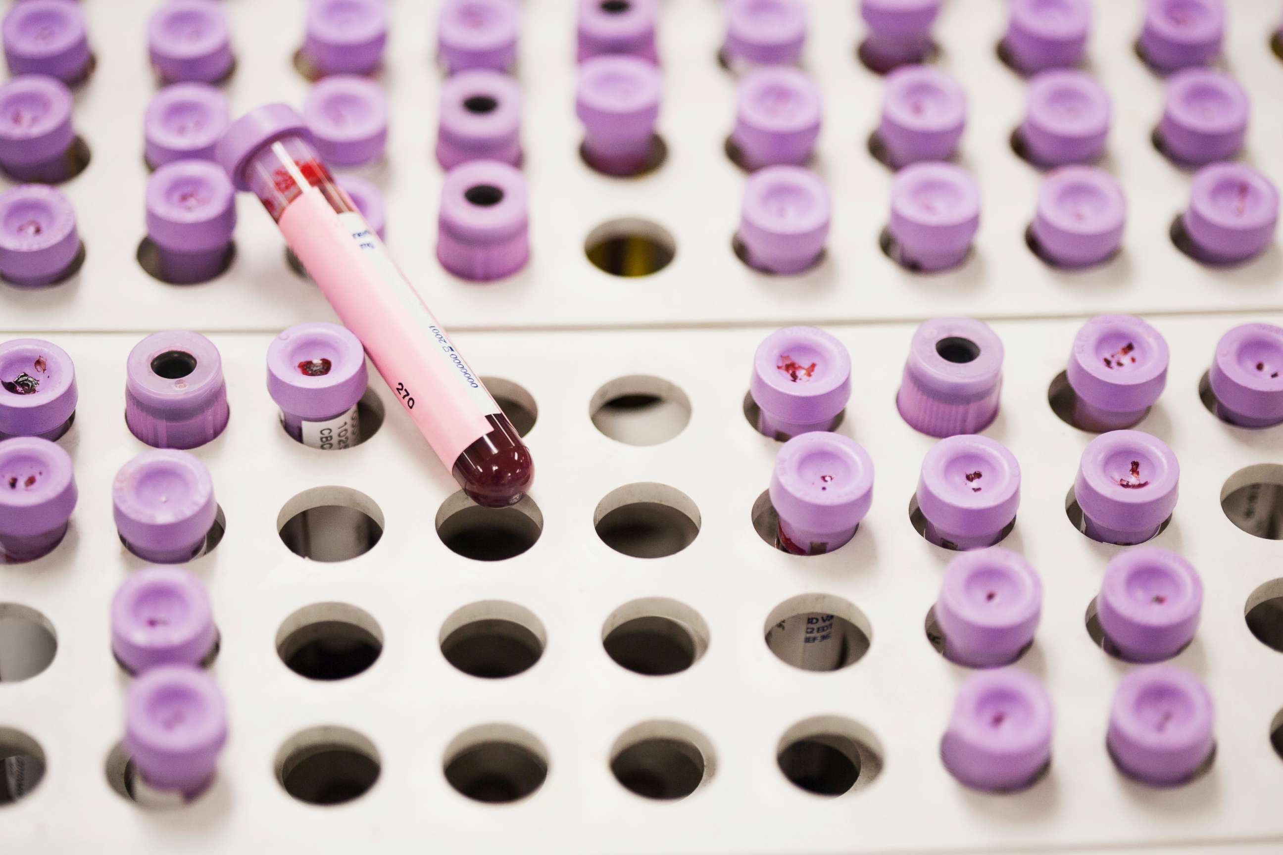 PHOTO: Vials are seen in this undated stock image.