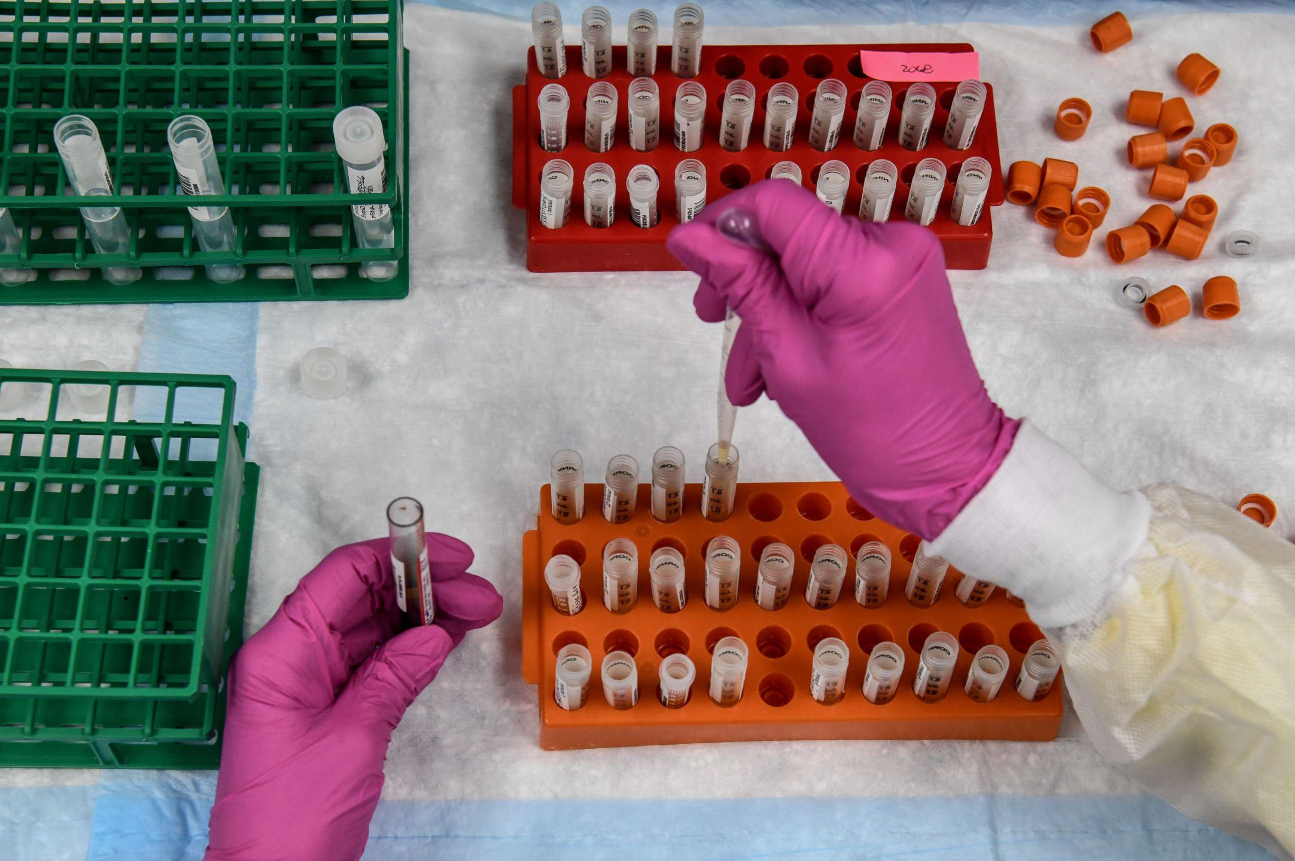 PHOTO: In this file photo taken on August 13, 2020, a lab technician sorts blood samples for a COVID-19 vaccination study at the Research Centers of America in Hollywood, Florida. 