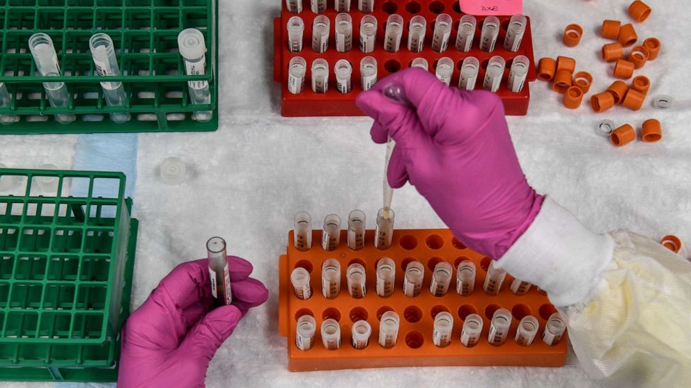 PHOTO: In this file photo taken on August 13, 2020, a lab technician sorts blood samples for a COVID-19 vaccination study at the Research Centers of America in Hollywood, Florida. 