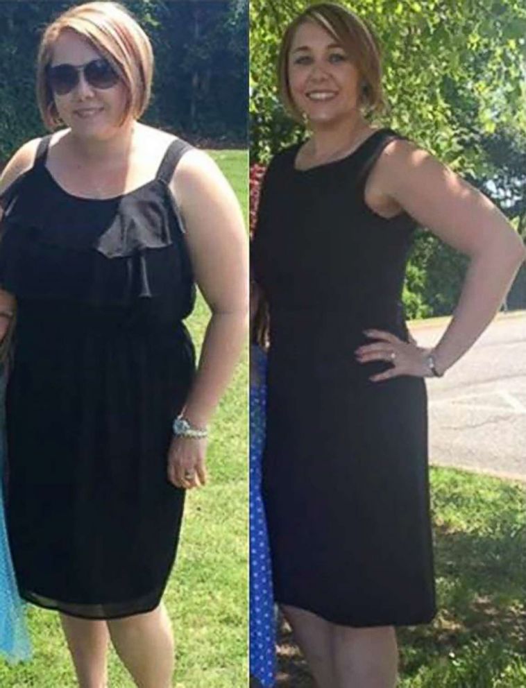 PHOTO: Brooke Everhart, of High Point, North Carolina, lost 50 pounds in nine months.