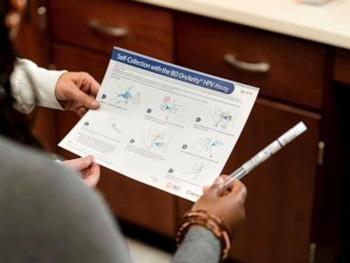 US health panel adds self-testing option for cervical cancer screening