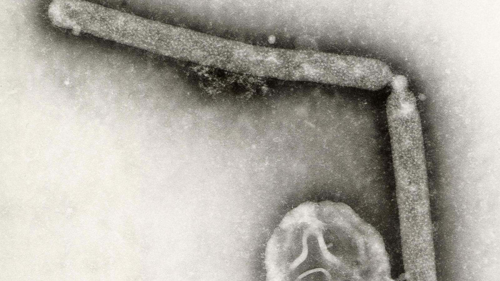 The US hasn't seen a human bird flu case in 3 months. Experts are wondering why