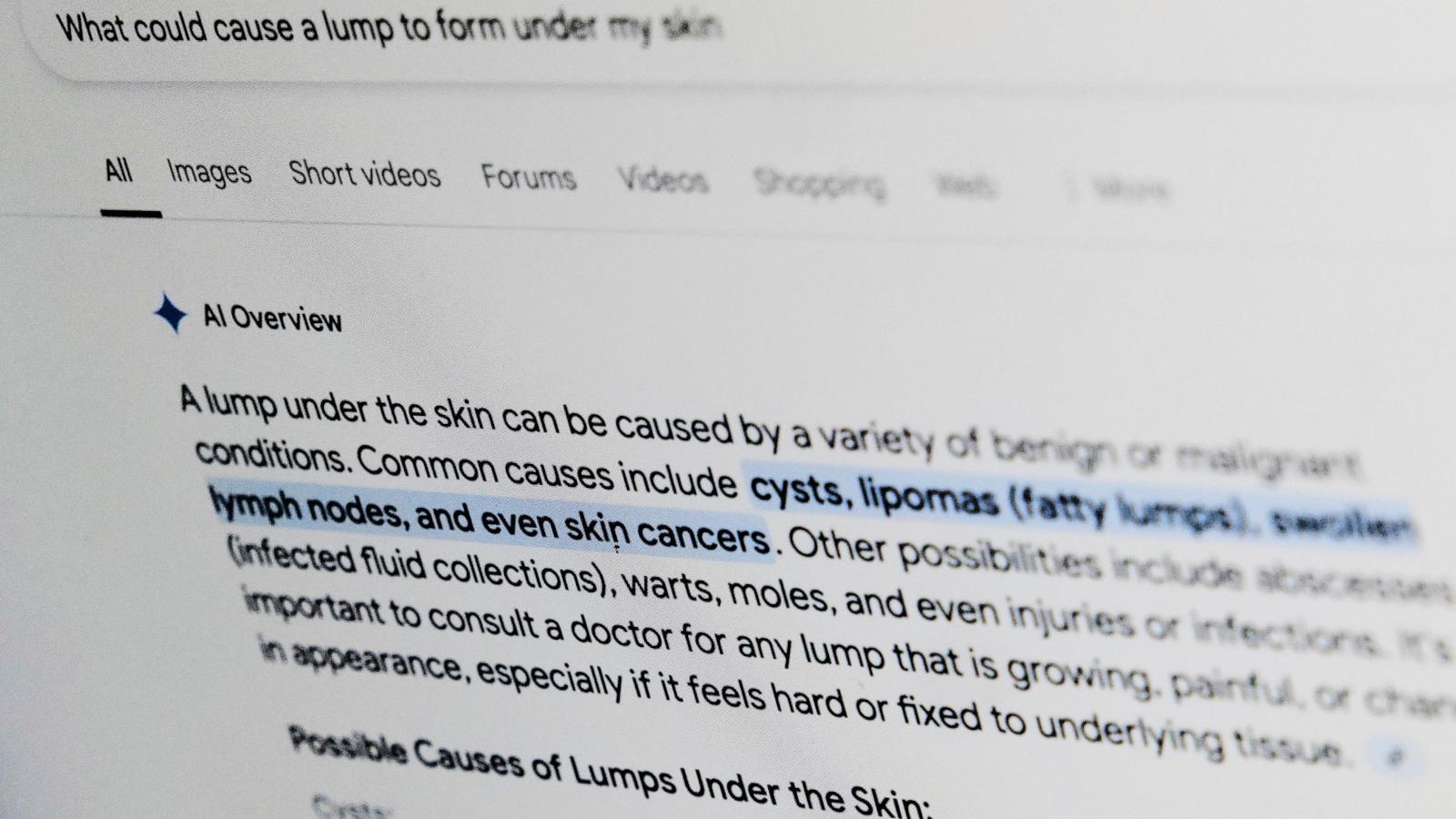 What’s that rash? Put some thought into asking Google for medical help