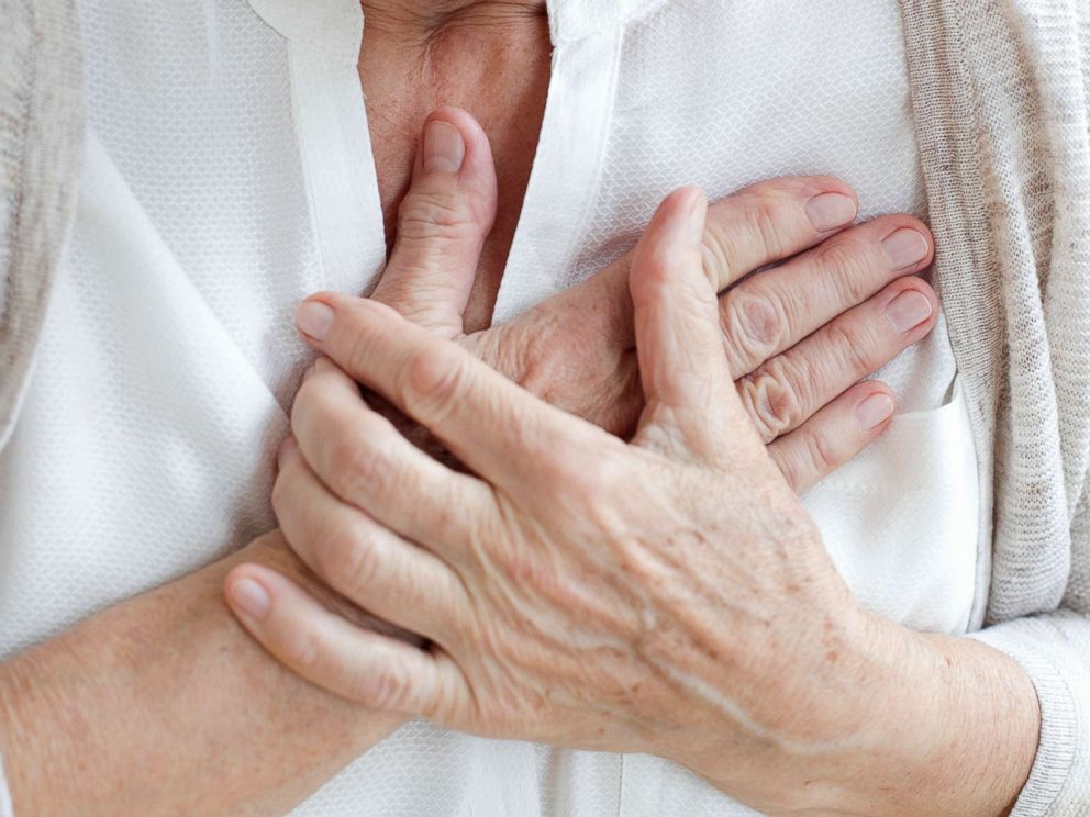 PHOTO: A senior woman holds her hands to her chest in an undated stock photo.