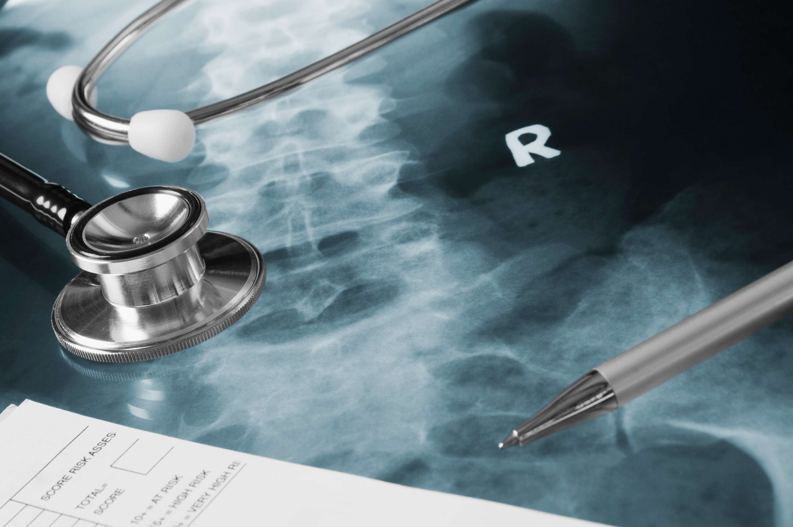 PHOTO: A stethoscope lies on x-ray.