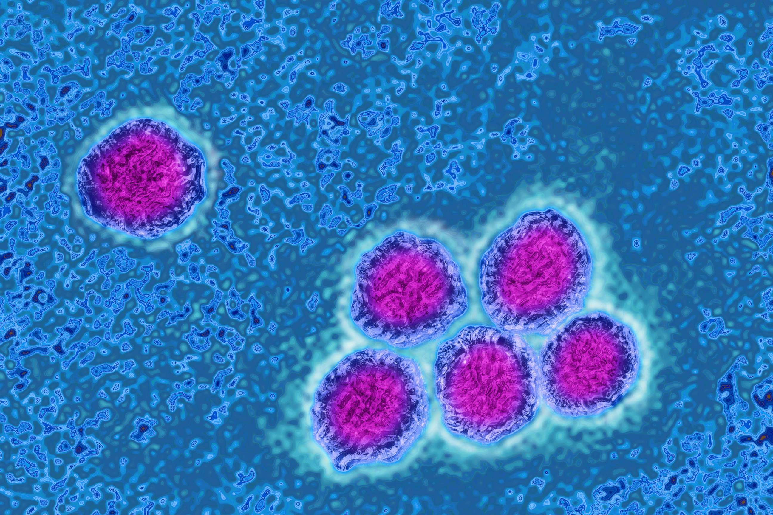PHOTO:Flavivirus (Flaviviridae family), these viruses are responsible for yellow fever, dengue fever, Japanese encephalitis, Zika virus and West Nile encephalitis. 