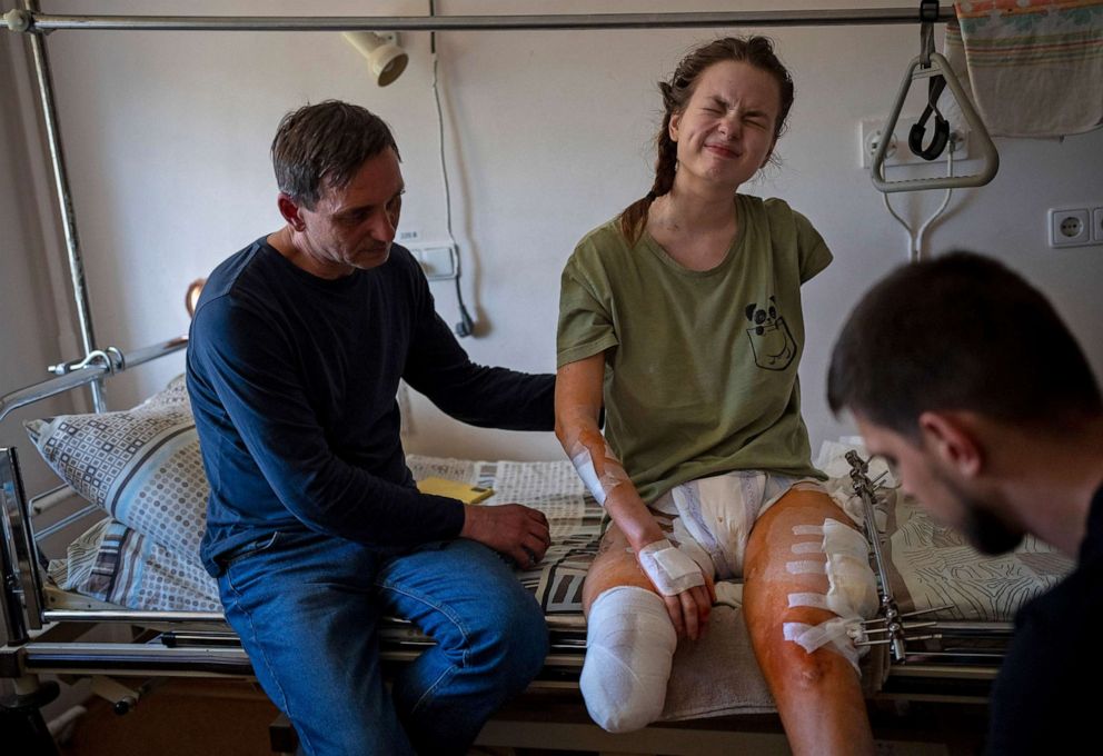 PHOTO: Nastia Kuzik, 21, reacts to pain while undergoing a rehabilitation session at a  hospital in Kyiv, Ukraine, May 5, 2022. She lost her right leg below the knee and seriously injured her left, after beig caught by bombing on March 17.