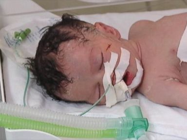 VIDEO: Baby Saved in Gaza