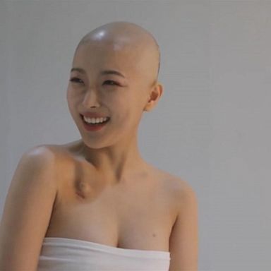 VIDEO: South Korean beauty YouTuber shares cancer diagnosis