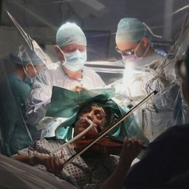 PHOTO: A patient at a British hospital played Mahler and Gershwin on the violin while surgeons removed a tumor from her brain, so doctors could preserve her ability to play music.