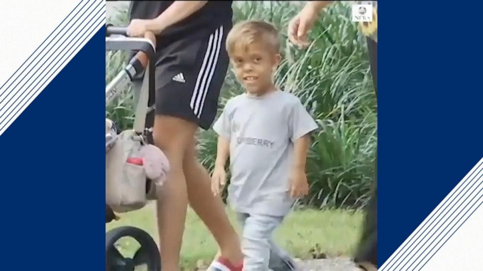VIDEO: Mom of bullied boy hopes viral video will raise awareness of dwarfism