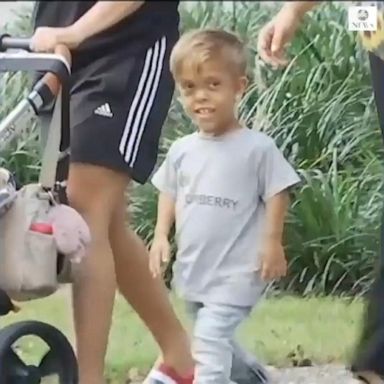 VIDEO: Mom of bullied boy hopes viral video will raise awareness of dwarfism