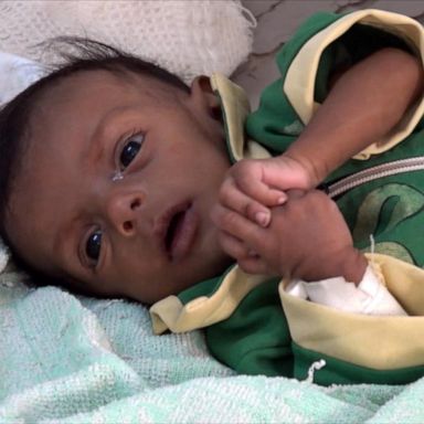 VIDEO: Yemen on the brink of starvation