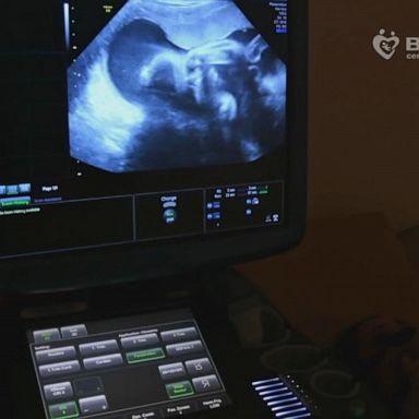 VIDEO: Ukrainian surrogacy agency does whatever it takes to keep its patients safe 