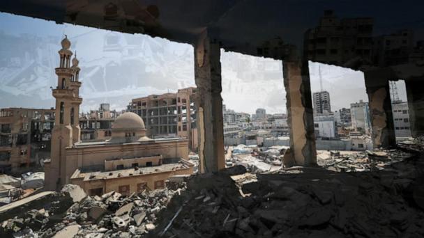 Limited aid to Gaza isn’t enough, doctors say