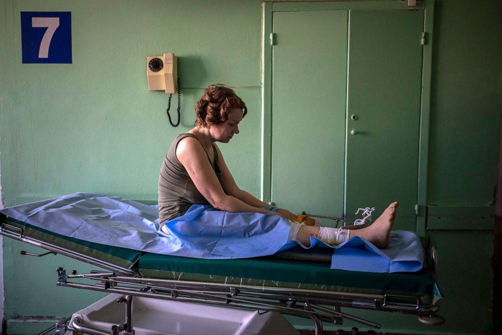 PHOTO: Olena Viter, 45, waits outside the operating theatre before a surgery, at a public hospital in Kyiv, Ukraine, May 10, 2022. Olena lost her leg and her 14-year-old son Ivan when bombs hit their village Rozvazhiv, in the Kyiv region, on March 14. 