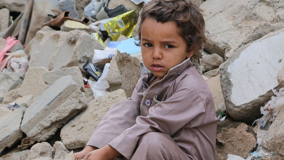 PHOTO: The continuing violence in Yemen is fuelling one of the worst hunger crises in the world, with nearly 7 million people not knowing where their next meal will come from and in desperate need of food assistance. 
