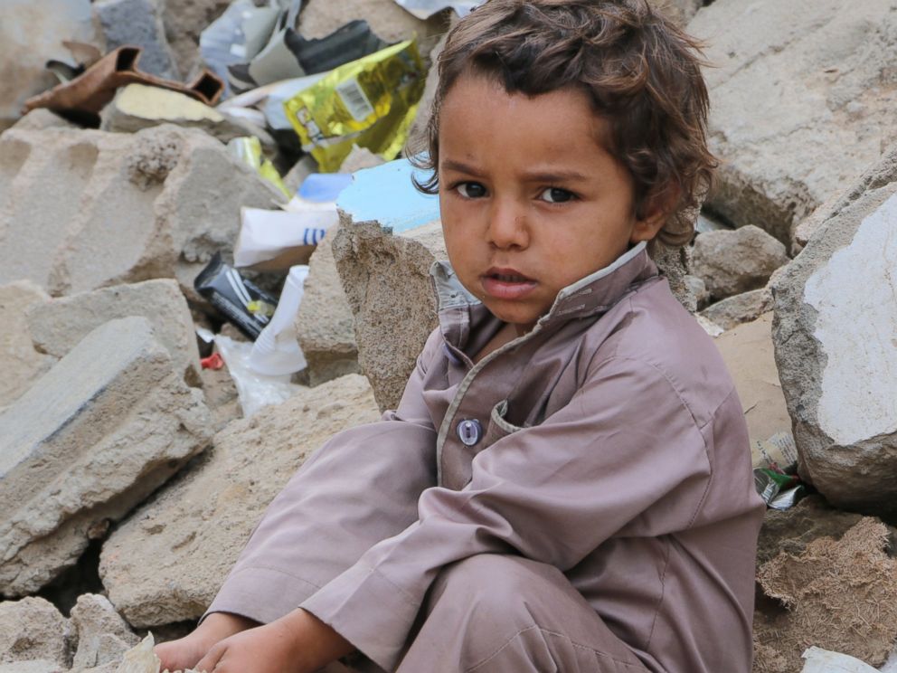 PHOTO: The continuing violence in Yemen is fuelling one of the worst hunger crises in the world, with nearly 7 million people not knowing where their next meal will come from and in desperate need of food assistance.