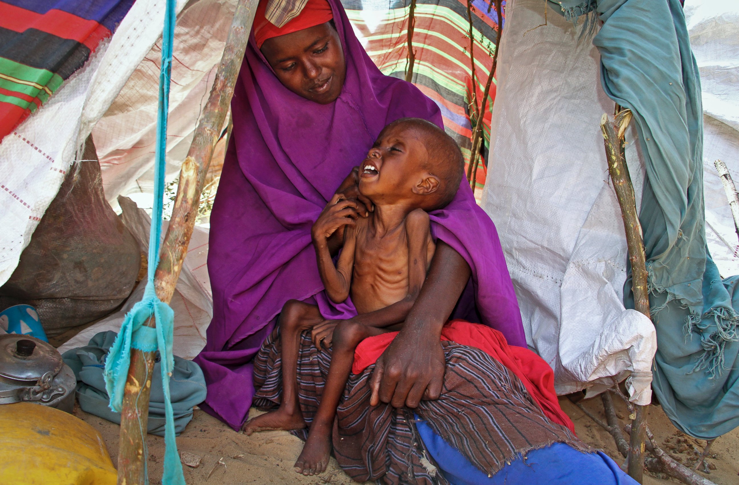 PHOTO: A newly displaced Somali mother Sahra Muse, 32, comforts her malnourished child Ibrahim Ali, 7, in their makeshift shelter at a camp in the Garasbaley area on the outskirts of Mogadishu, Somalia, on March 28, 2017. 