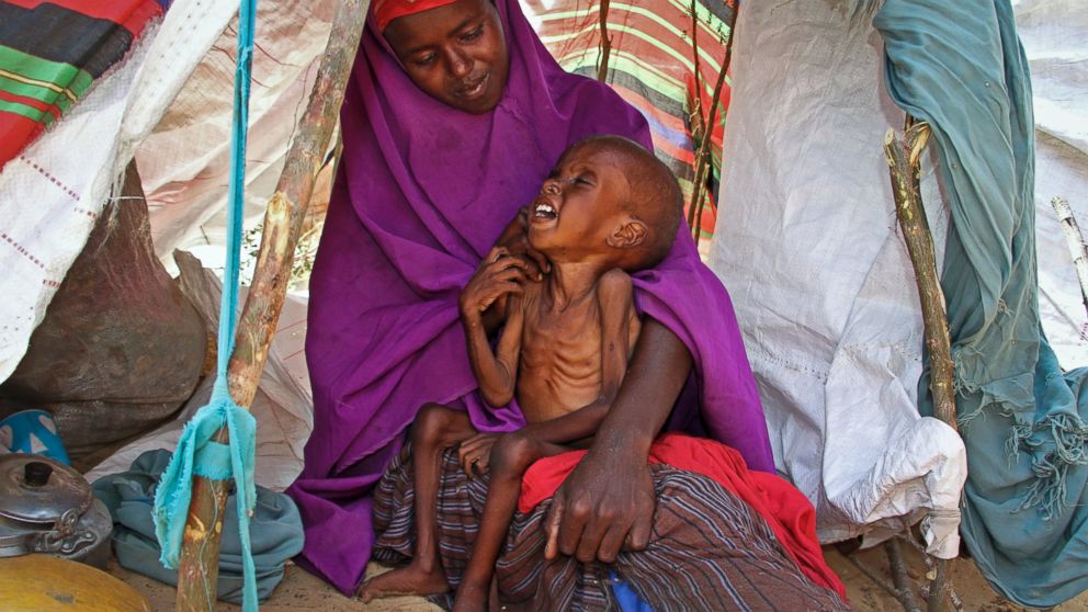 PHOTO: A newly displaced Somali mother Sahra Muse, 32, comforts her malnourished child Ibrahim Ali, 7, in their makeshift shelter at a camp in the Garasbaley area on the outskirts of Mogadishu, Somalia, on March 28, 2017.