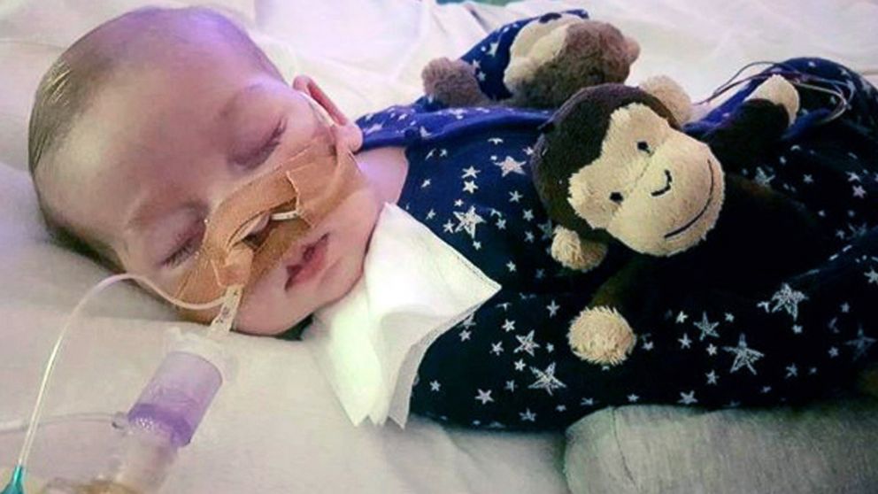 PHOTO: This is an undated hand out photo of Charlie Gard provided by his family, at Great Ormond Street Hospital, in London. 