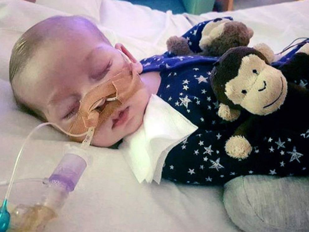 PHOTO: This is an undated hand out photo of Charlie Gard provided by his family, at Great Ormond Street Hospital, in London.