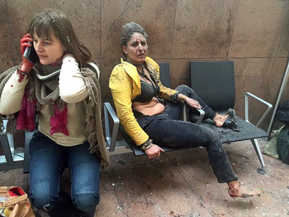 PHOTO: Two women wounded in Brussels Airport in Brussels, after explosions were heard, March 22, 2016.