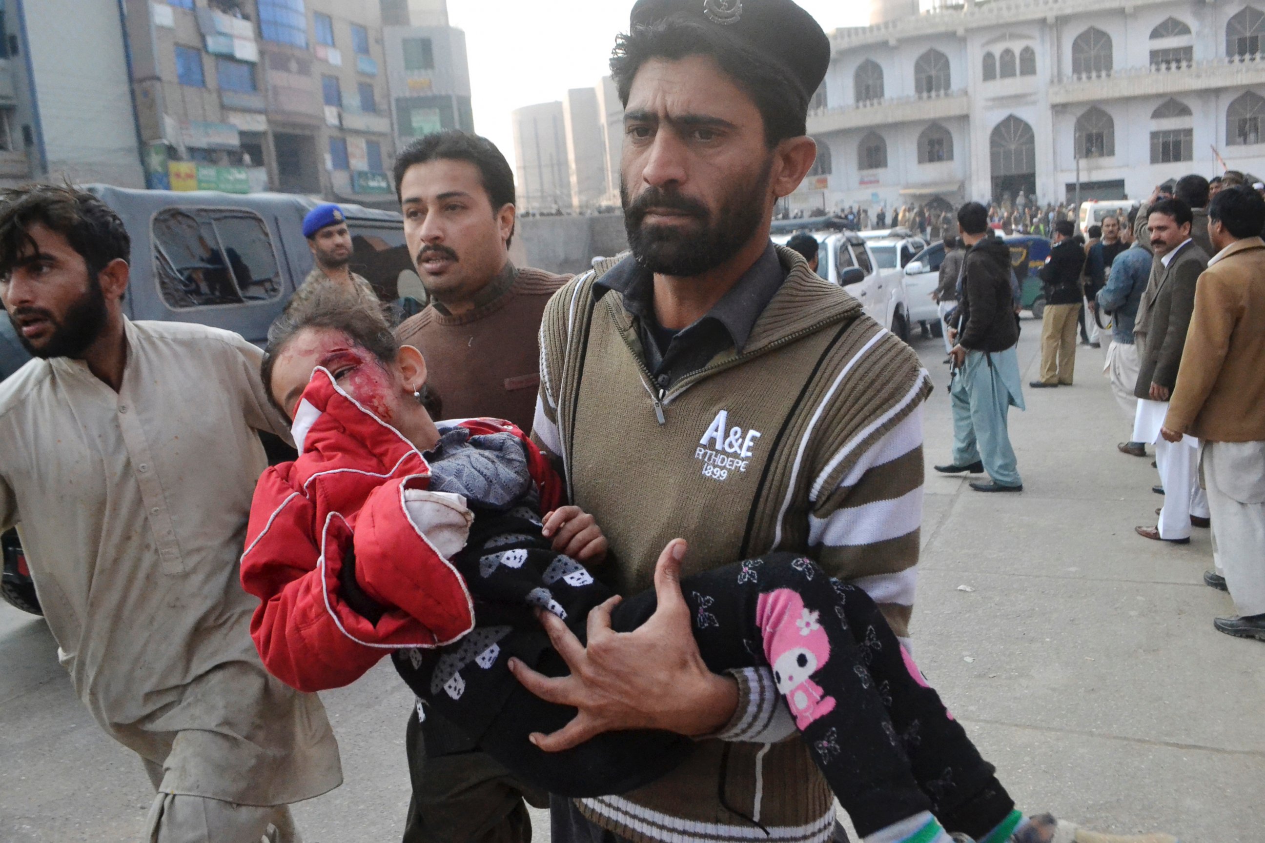 PHOTO: A Pakistani girl, who was injured in a Taliban attack in a school, is rushed to a hospital