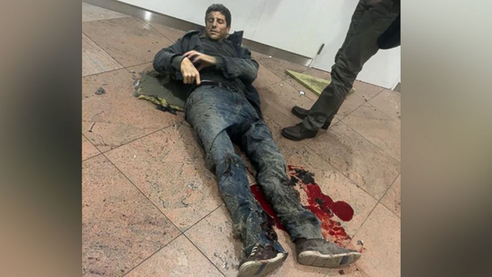 PHOTO: Brazilian basketball player Sebastien Bellin, who formerly played for the Belgian national basketball team, lies wounded on the floor of the Brussels Airport in Brussels, Belgium, after explosions ripped through the departure hall, March 22, 2016.