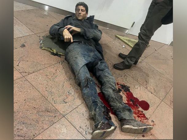 PHOTO: Brazilian basketball player Sebastien Bellin, who formerly played for the Belgian national basketball team, lies wounded on the floor of the Brussels Airport in Brussels, Belgium, after explosions ripped through the departure hall, March 22, 2016.