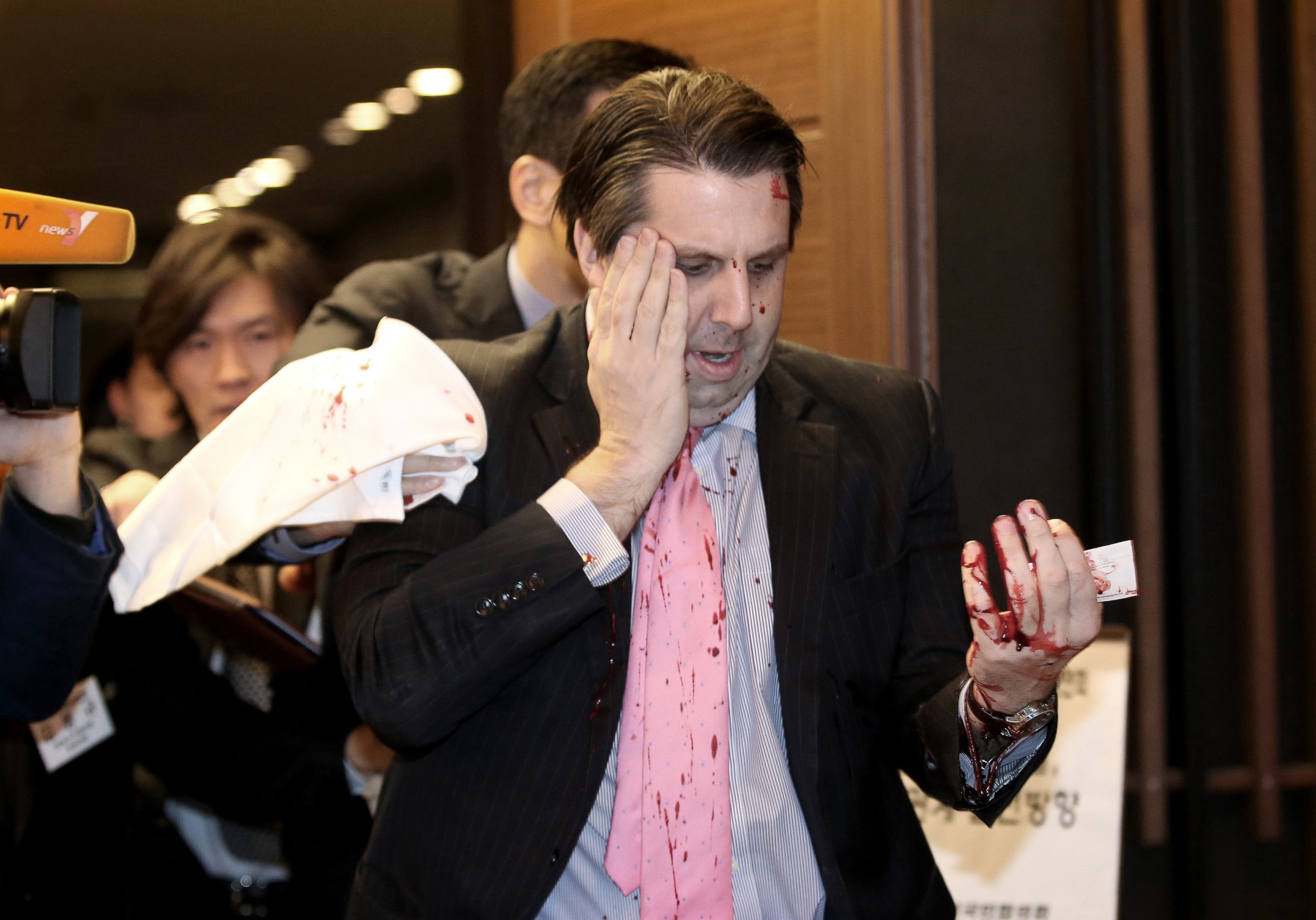 PHOTO: U.S. Ambassador to South Korea Mark Lippert leaves a lecture hall for a hospital in Seoul, South Korea, March 5, 2015, after being attacked by a man.