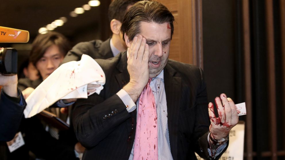 PHOTO: U.S. Ambassador to South Korea Mark Lippert leaves a lecture hall for a hospital in Seoul, South Korea, March 5, 2015, after being attacked by a man.