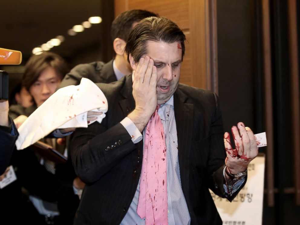 PHOTO: U.S. Ambassador to South Korea Mark Lippert leaves a lecture hall for a hospital in Seoul, South Korea, March 5, 2015, after being attacked by a man.