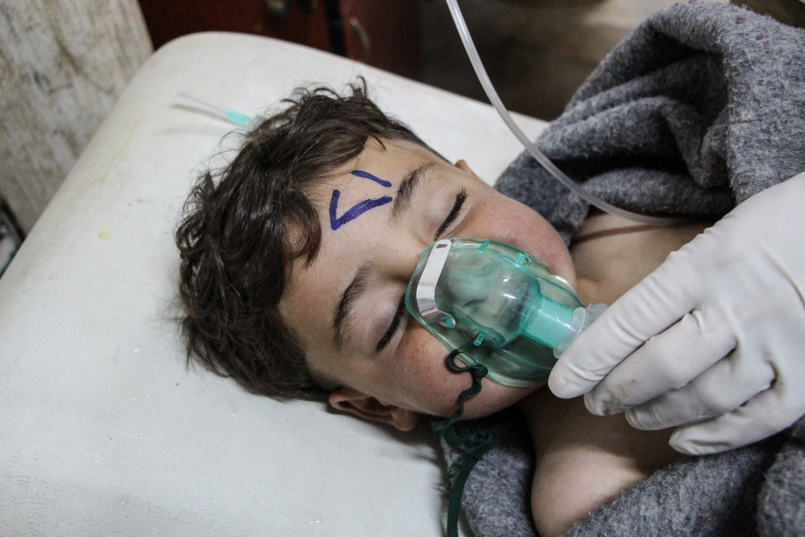 PHOTO: A Syrian child receives treatment after an alleged chemical attack at a field hospital in Saraqib, Idlib province, Syria, April 4, 2017. 